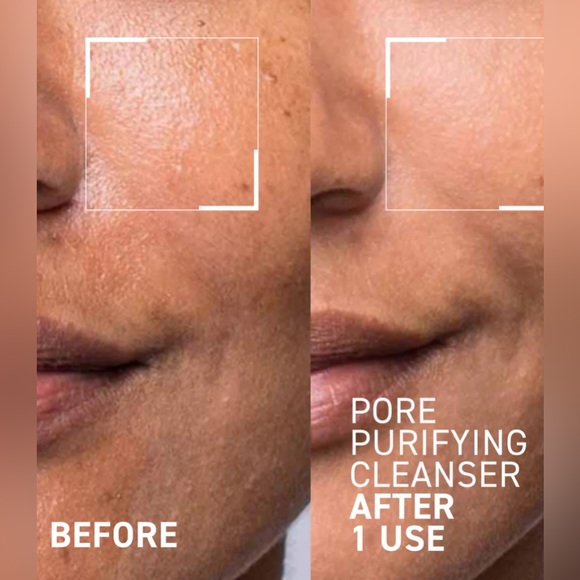 DR. BRANDT SKINCARE Pores No More Pore Purifying Cleanser New 15ml Deluxe Mini - Picture 7 of 8